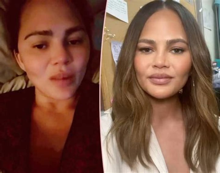 Chrissy Teigen Claps Back After Troll Wonders If She Has Cancer Or If She’d Lost 50 Pound Overnight – ‘You Look Unrecognizable!’