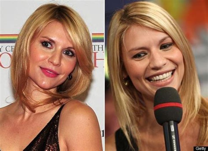 Claire Danes Plastic Surgery Before and After
