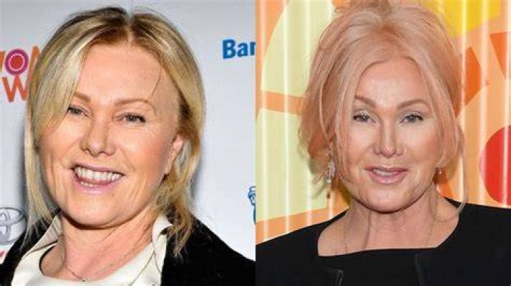 Deborra-Lee Furness’ Plastic Surgery: She Looked Young As Ever in Met Gala 2023!