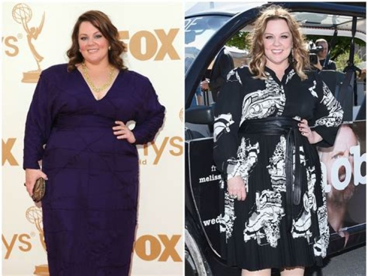 Did Melissa McCarthy have bariatric surgery? How did Melissa McCarthy lose all that weight?