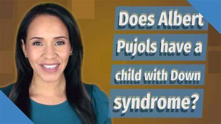 Does Albert Pujols have a child with Down syndrome?