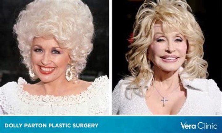 Dolly Parton Plastic Surgery: Parton's Journey of Tucking It, Sucking It or Plucking It!