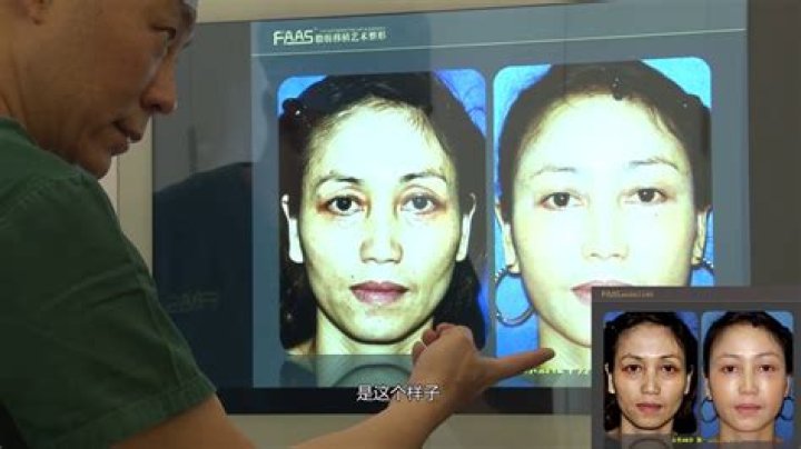 Dr. Yue Li, MD – Philadelphia, PA