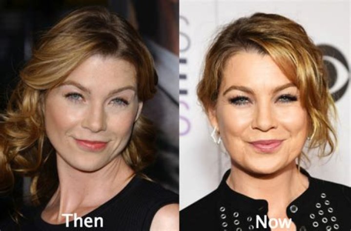 Ellen Pompeo Plastic Surgery Before and After