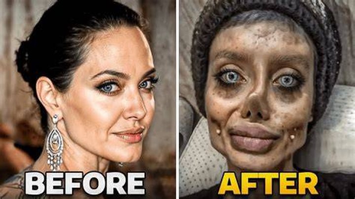 Erykah Badu Plastic Surgery Before And After: What Is Wrong With Her Face?