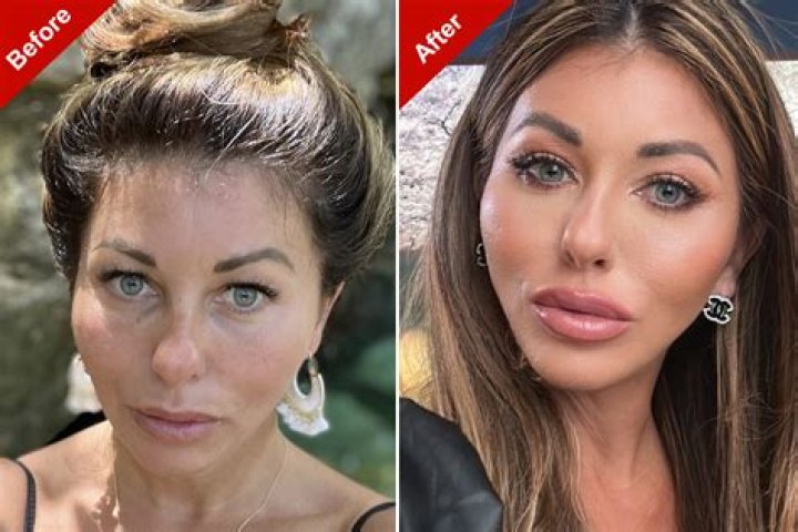 Has Mike Myers Done Plastic Surgery ?Then Vs Now Photos