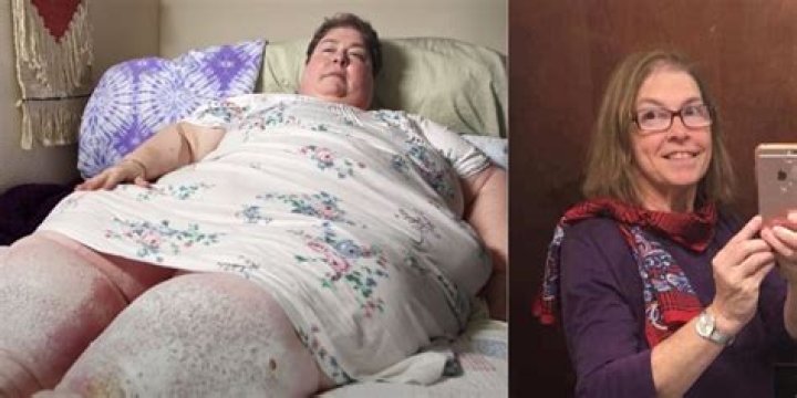 How Much Do The Patients On My 600 Pound Life Get Paid? – Celebrity