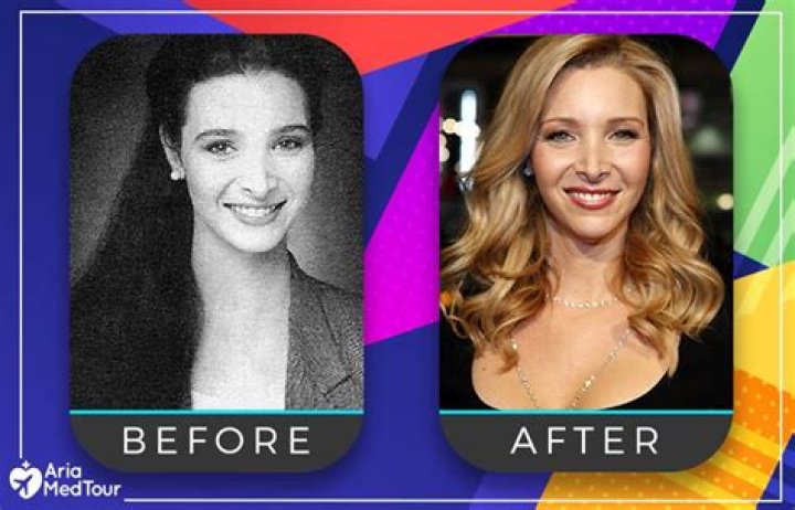Is Alyssa From Charles And Alyssa Pregnant? Before And After Nose Job Plastic Surgery