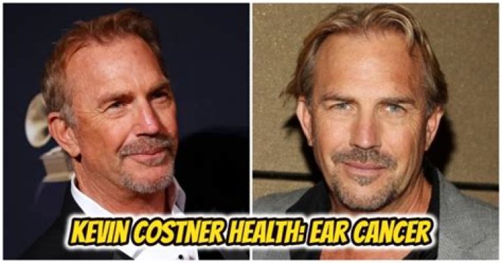 Kevin Costner ear cancer surgery