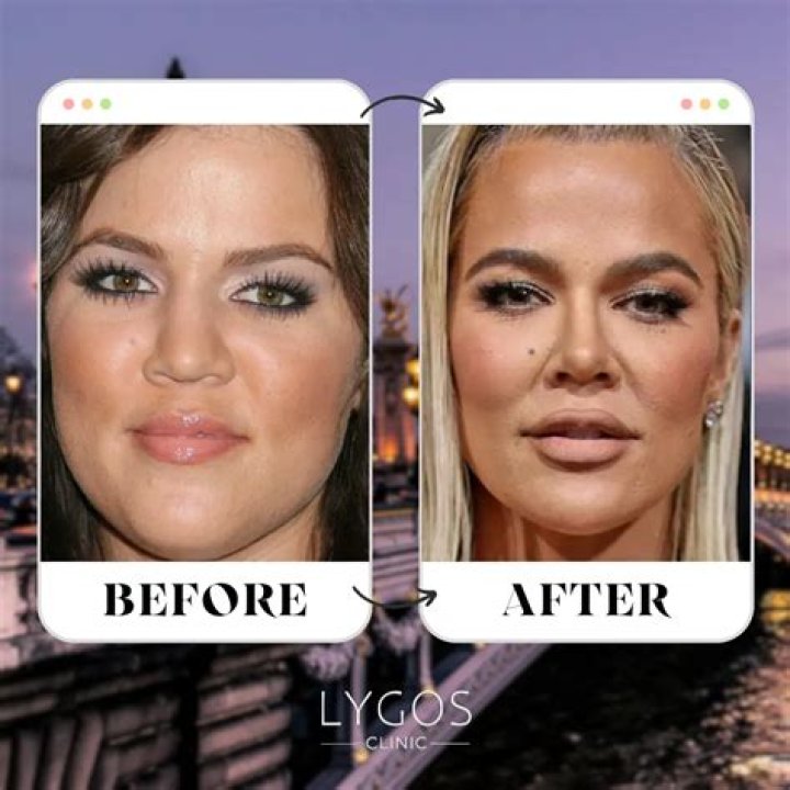 Khloe Kardashian Addresses Nose Job Rumors In Makeup Tutorial Video While Cuddling True Thompson