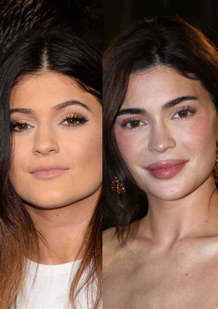 KUWTK: Kylie Jenner Recalls A Guy Made Her Feel ‘Unkissable’ Before Getting Lip Fillers!