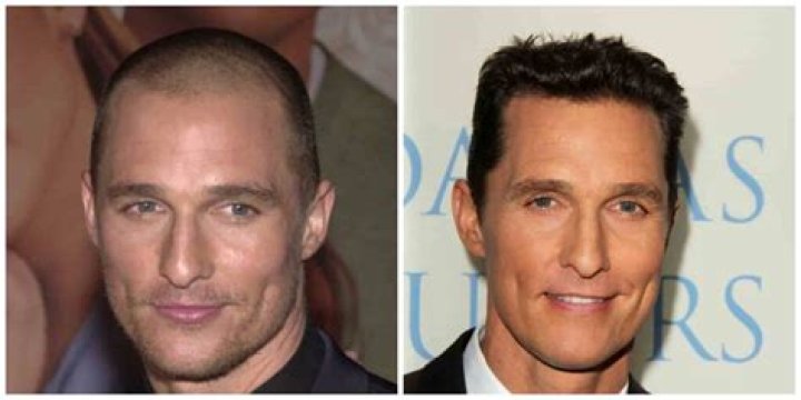 Matthew McConaughey did an odd thing to regrow his hair after nearly going bald