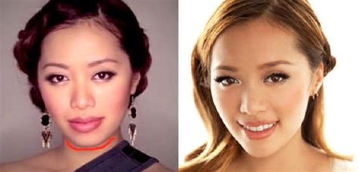 Michelle Phan Plastic Surgery Before and After
