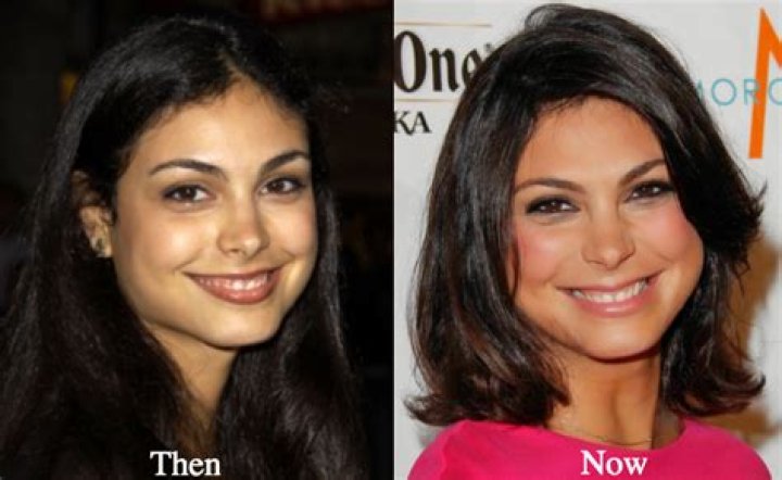 Morena Baccarin Plastic Surgery Before and After