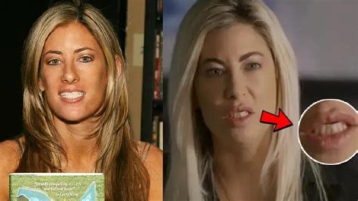 Netflix: What Happened To Jennifer Saginor’s Teeth? Meet The Dr. Mark Saginor Daughter On Instagram