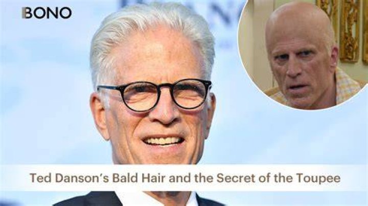 Pictures: Is Ted Danson Bald, What Happened To His Hair?