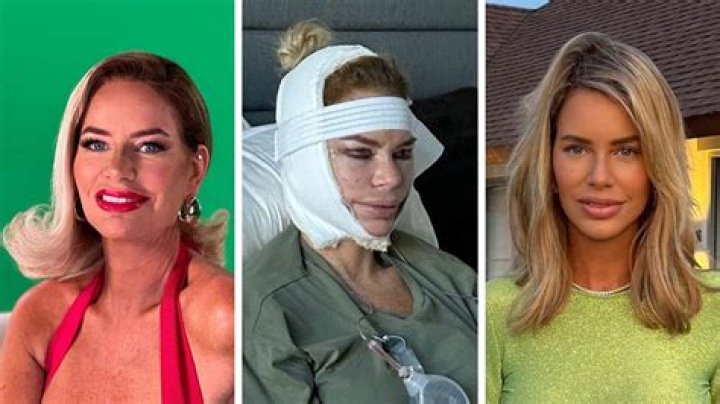 Real House Wives Of Dubai: Caroline Stanbury Before And After Plastic Surgery Pictures