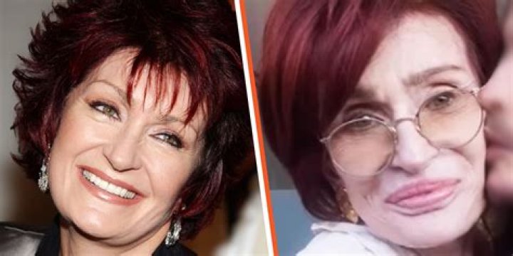 Sharon Osbourne Opens Up About Her Facelift Surgery – ‘I Can’t Feel My Mouth’