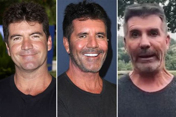 Simon Cowell health: What disease does Simon Cowell have? Rectal cancer explained
