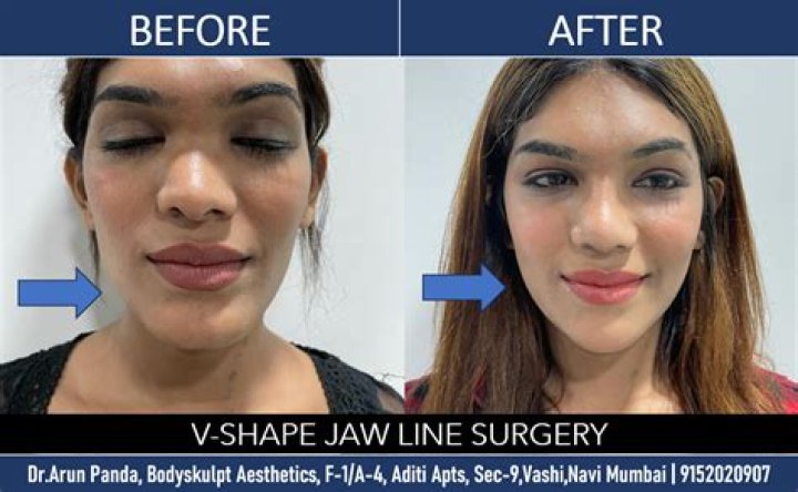Socialite Amelia Pounds d!es whiles undergoing body enhancement surgery in India