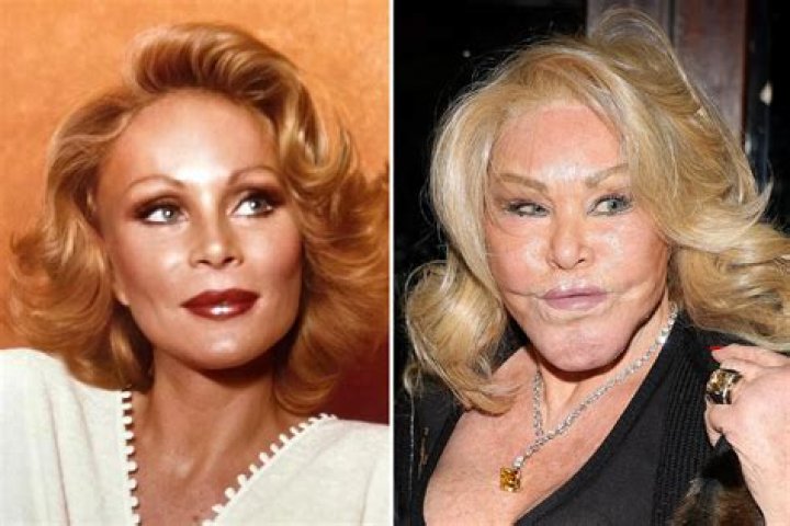 Socialite Jocelyn Wildenstein Before Surgery: Botched Transformation Gone Wrong Photos