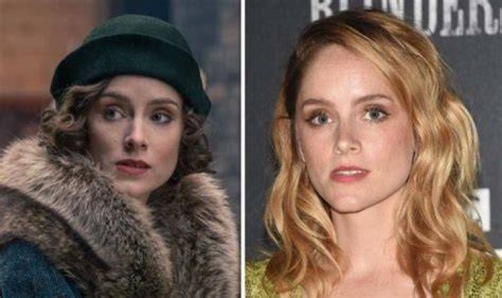 Sophie Rundle Plastic Surgery: Has She Done Jaw Surgery And Botox