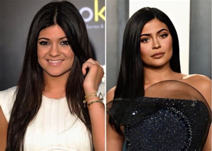 These Before And After Photos Of Kylie Jenner Will Have You Doing A Double Take