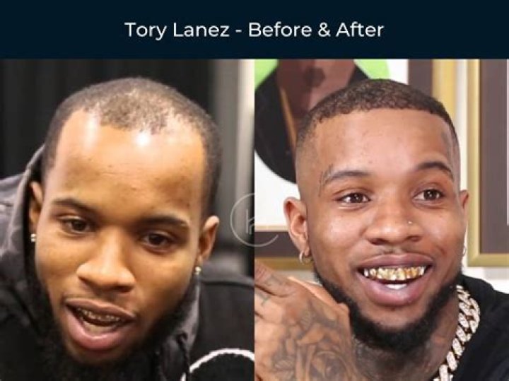 Tory Lanez Height, Age, Net Worth 2022, Hair , All Facts