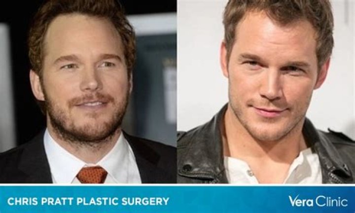 What Did Chris Pratt Do To Set Off Twitter Users Who Labeled Him As ‘The Worst Chris?’