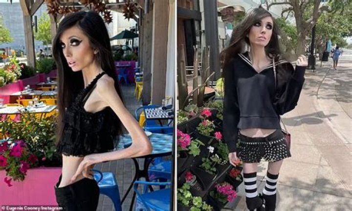 What did Eugenia Cooney look like before illness? Her before and after anorexia photos