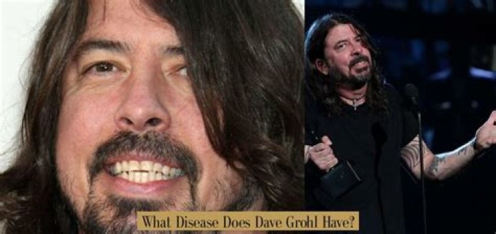 What disease does Dave Grohl have?