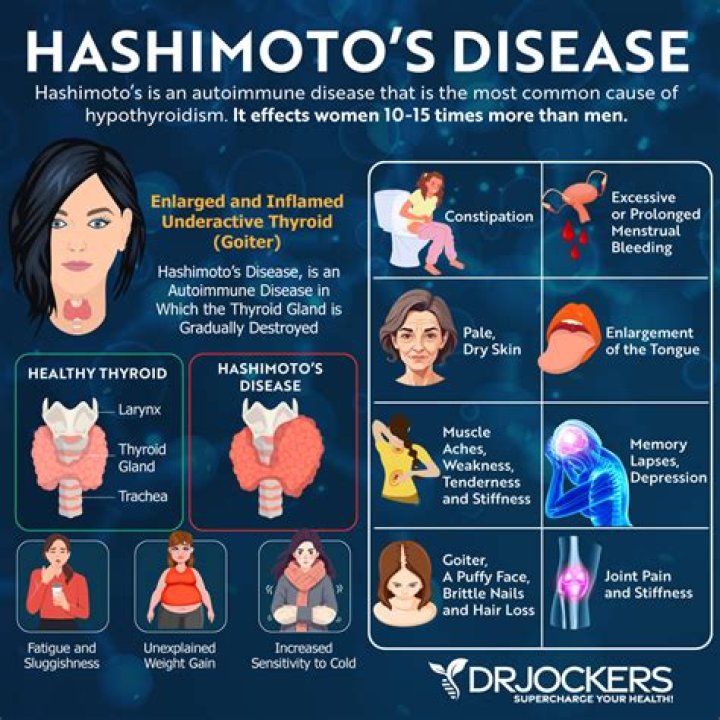 What disease does Gina Rodriguez have? Hashimoto’s disease explained