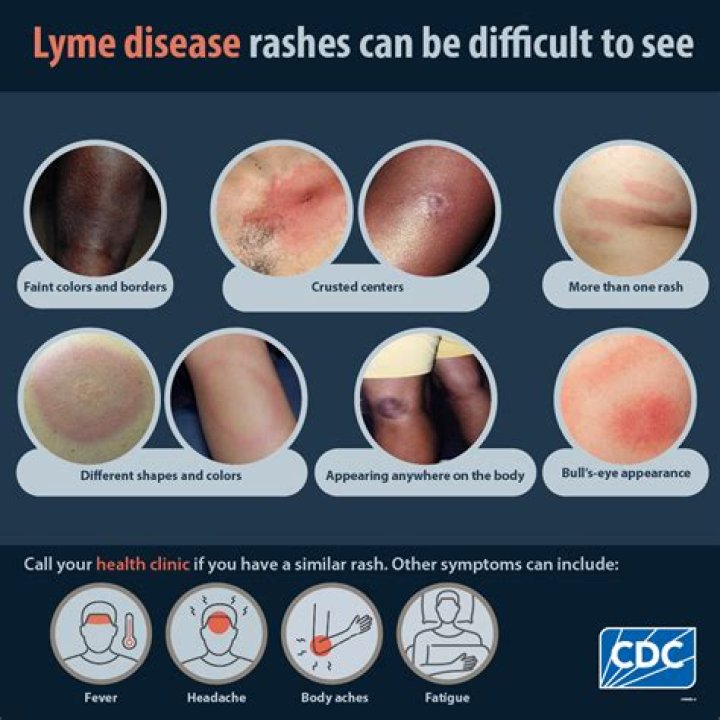 What disease does Mark Shields have? Mark Shields illness explained