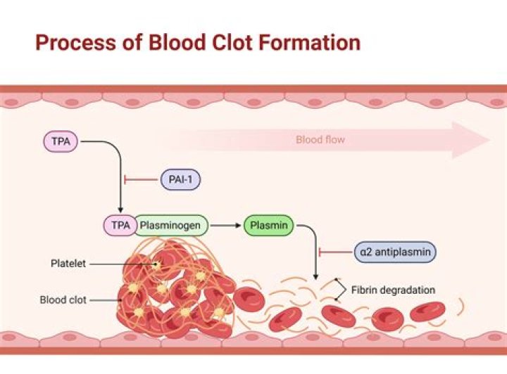 What happened to Justin Thomas father? Blood clot explained