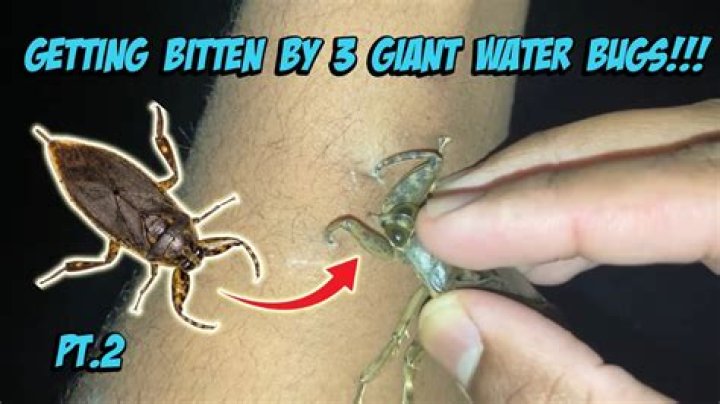 What happens if a giant water bug bites you? – Celebrity