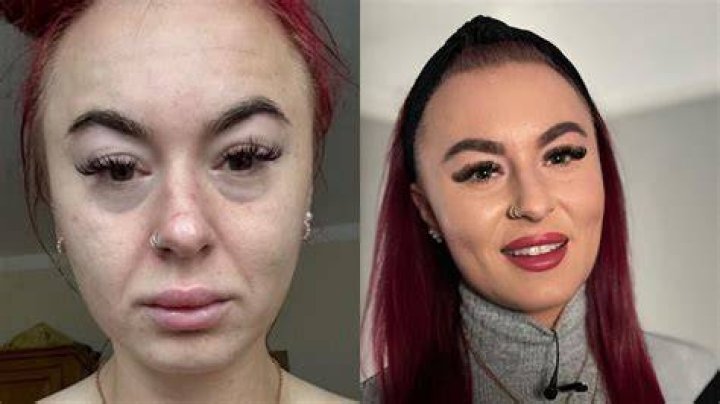 What Surgery Did Karla J Get? Before And After Photos Of The Model And Fitness Freak