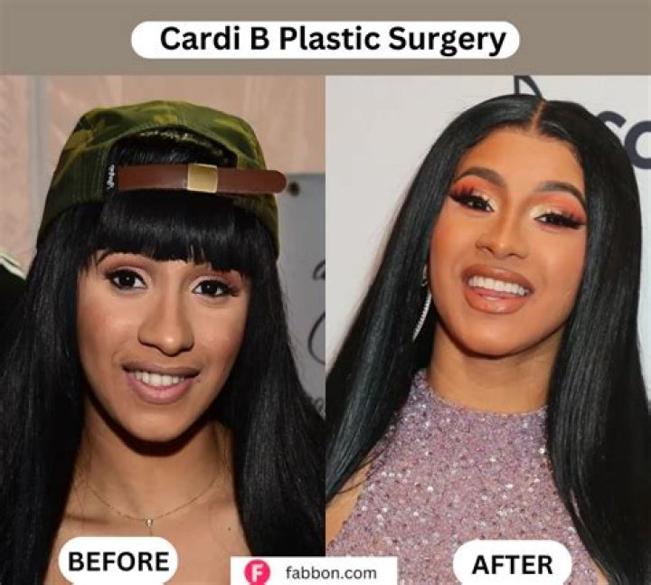 Where Did Cardi B Get Her Teeth Done At? – Celebrity