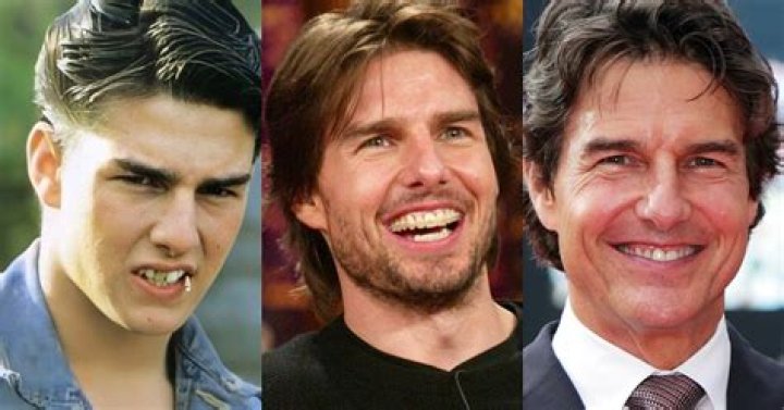 Who Did 69 Teeth? – Celebrity