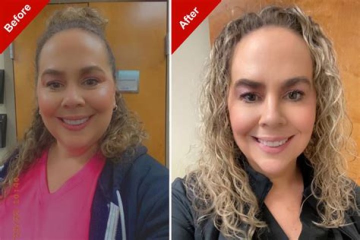 Who Is Gigi De Lana Surgery Doctor? Before And After Pictures