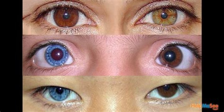Who Is Pete Hegseth? Des He Have Two Different Colored Eyes