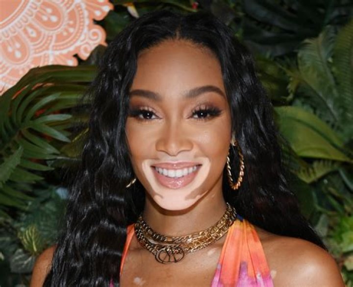 Winnie Harlow in Bathing Suit is "Glowy" — Celebwell