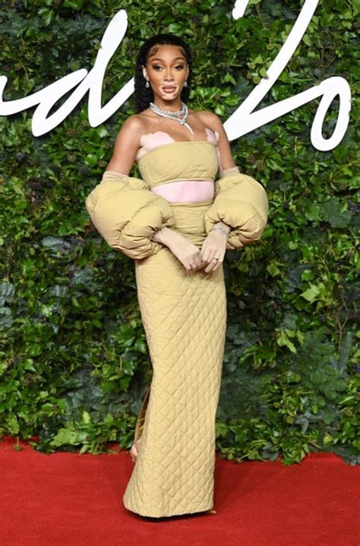 Winnie Harlow in Bathing Suit Says Hi From Dubai — Celebwell